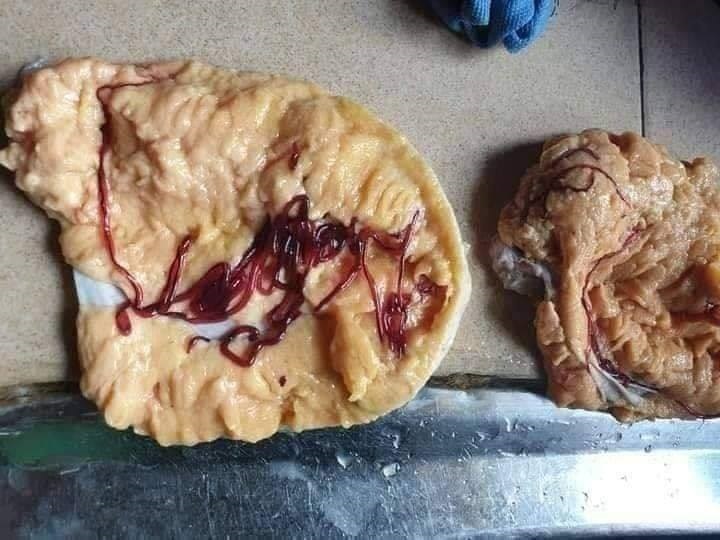 สะพรึง เส้นสีแดงในไข่ปลา 