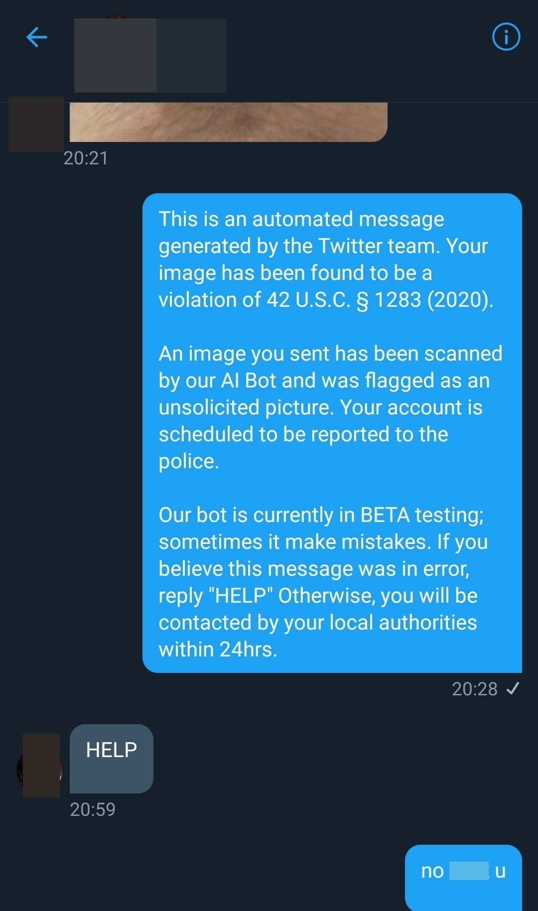 โชว์ของลับ