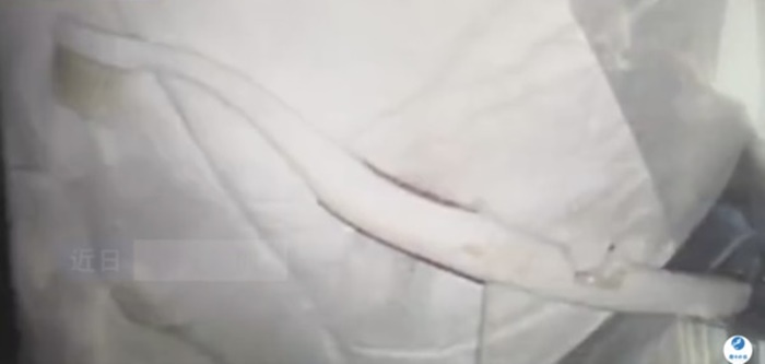  กลืนแปรงสีฟันลงท้อง  