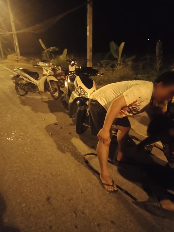  เลียนแบบ Squid Game