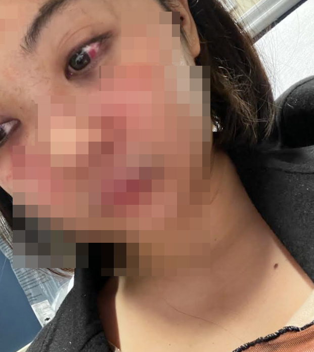 สาวไทยถูกทำร้ายในนิวยอร์ก 