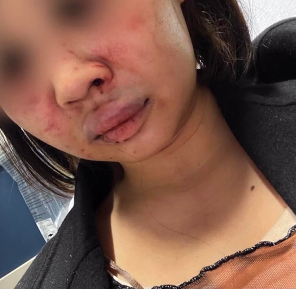 สาวไทยถูกทำร้ายในนิวยอร์ก 