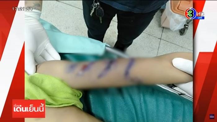 พ่อเลี้ยงโหดทำร้ายลูกเลี้ยง  