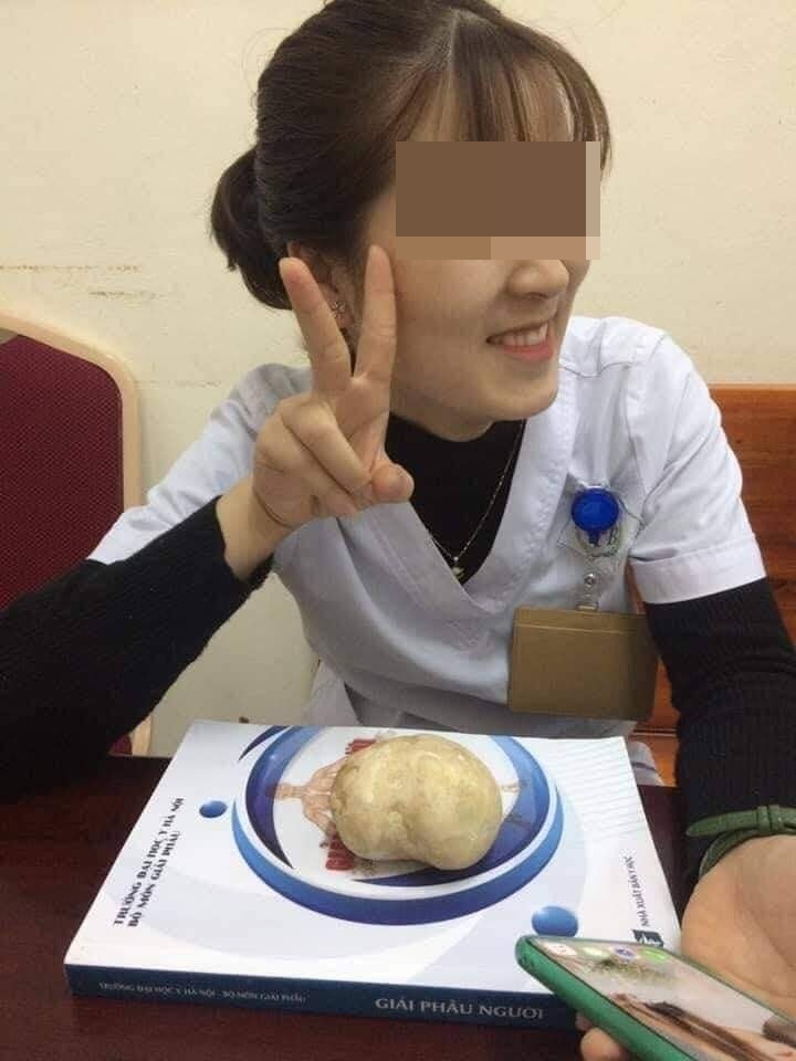 นิ่วยักษ์ หนักเกือบครึ่งกิโล