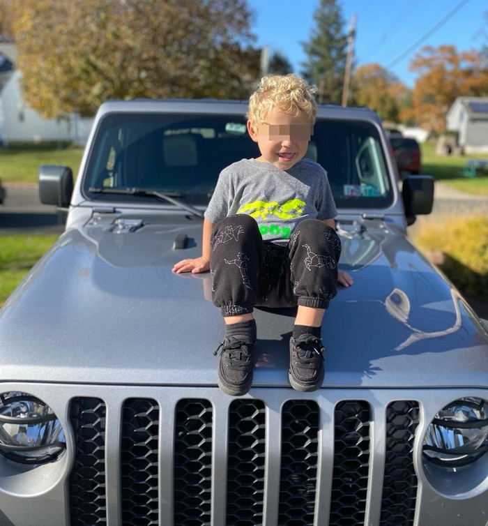 ลิ้นโตแต่กำเนิด