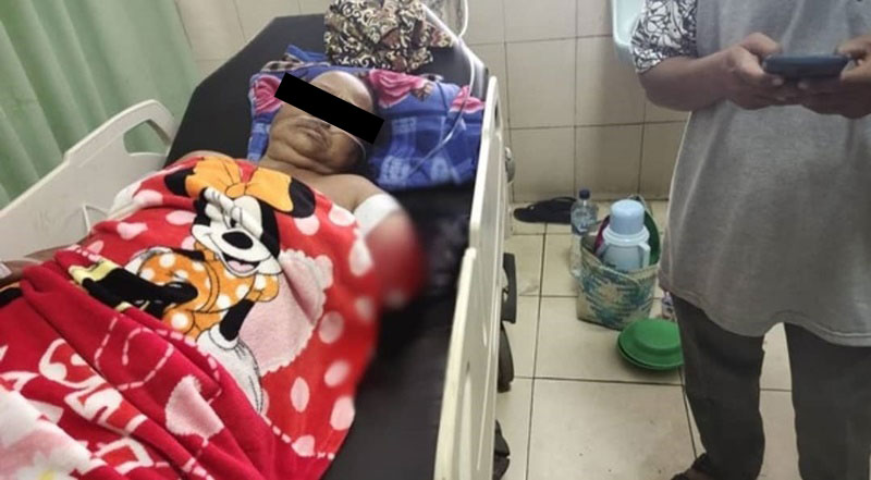 จระเข้กัด