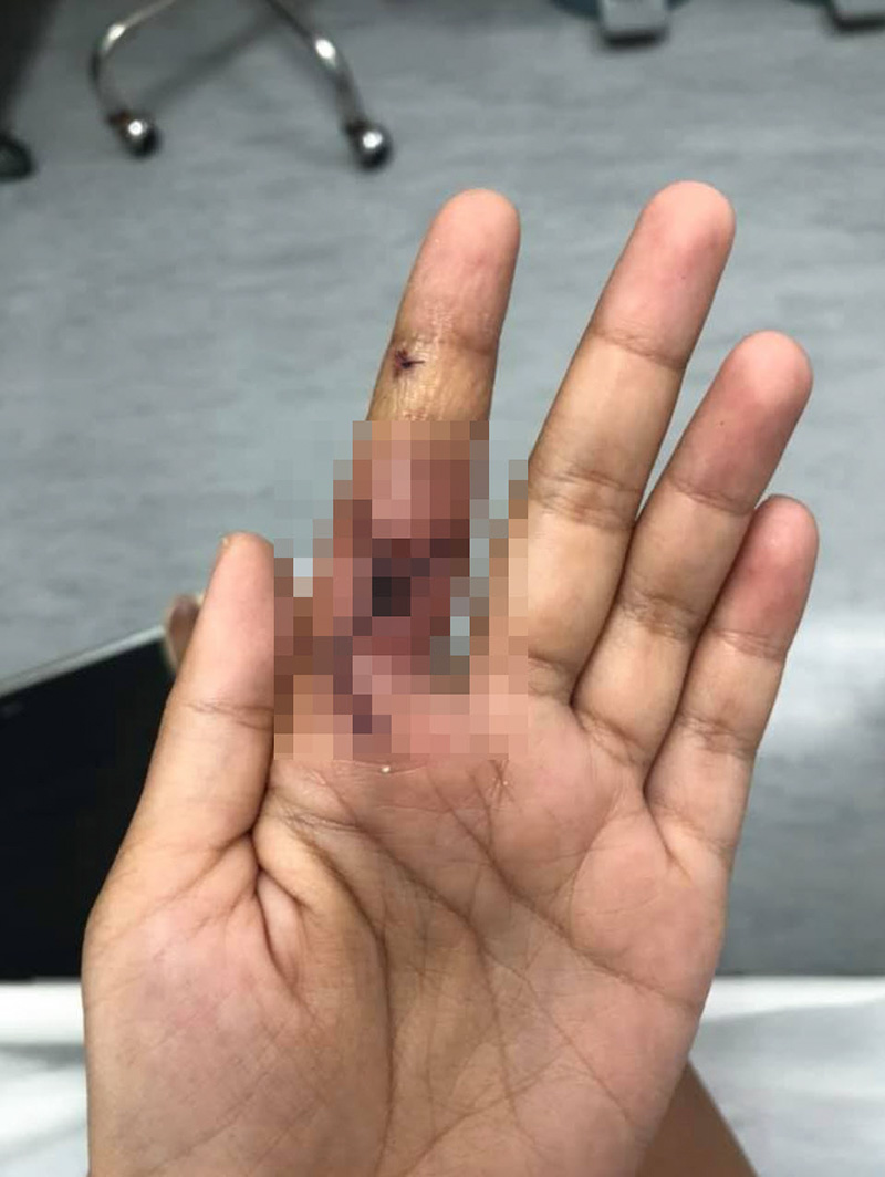 ก็อตซิลล่า กัดมือนักข่าว