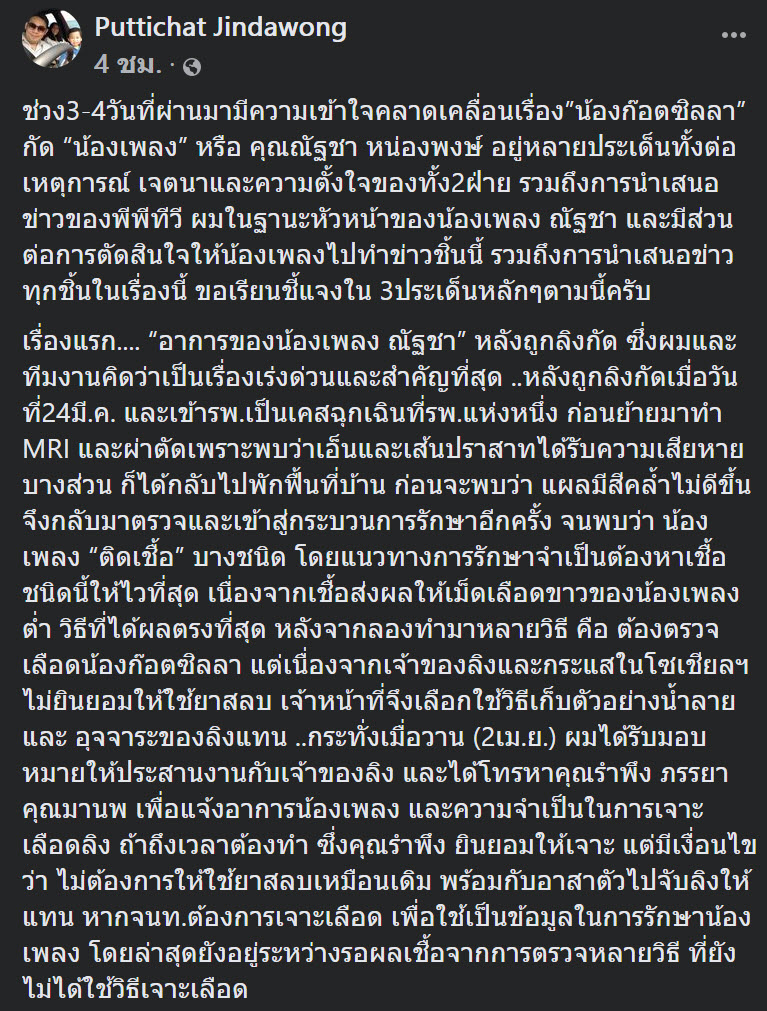 ก็อตซิลล่า กัดมือนักข่าว