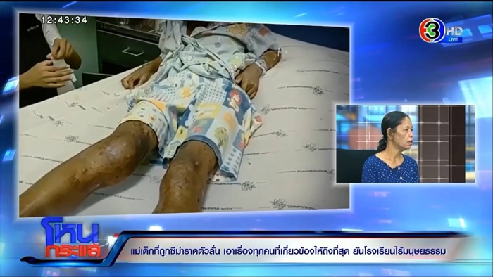  เด็ก 9 ขวบ โดนราดซีม่า