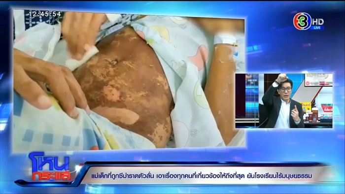  เด็ก 9 ขวบ โดนราดซีม่า