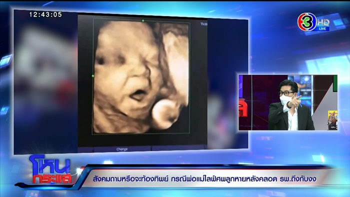 ท้องปลอม