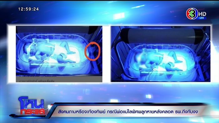 ท้องปลอม