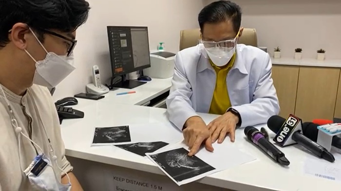 ท้องปลอม