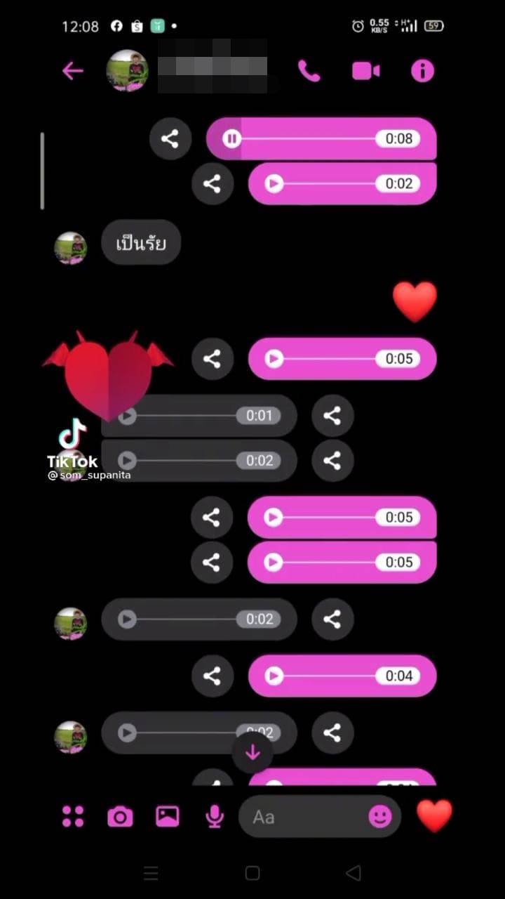  น้องแม่หัวแตก เลือดไหล