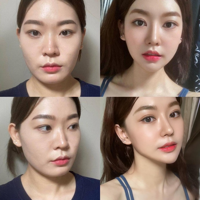 ศัลยกรรม