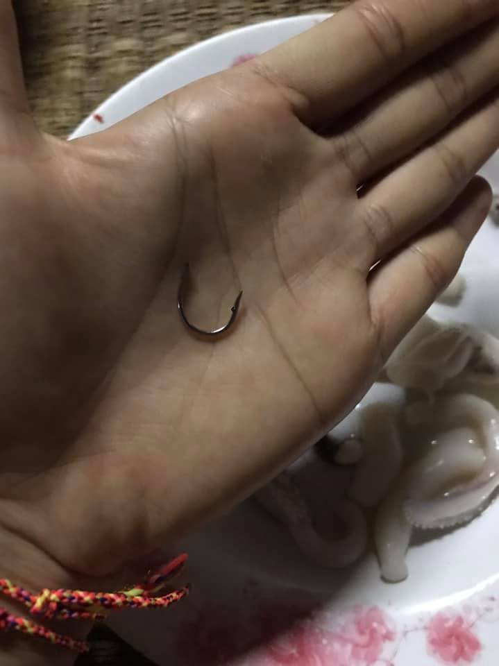 สิ่งแปลกปลอมในอาหาร