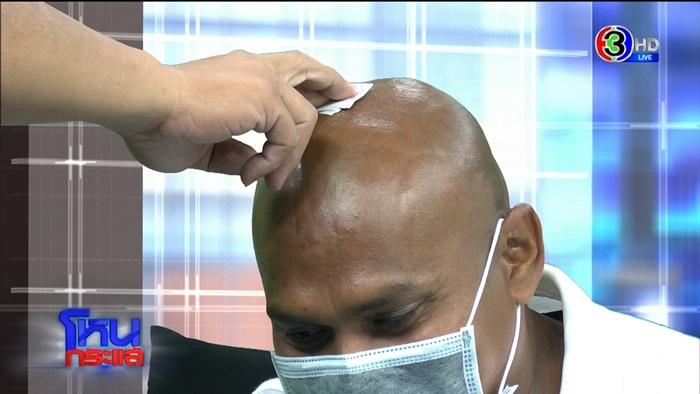 เสกทองคำเปลวเข้ากะโหลก ?!