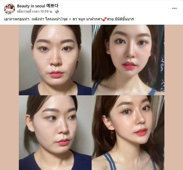 ศัลยกรรม