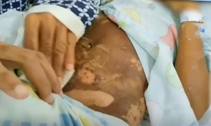 เด็กโดนซีม่า 