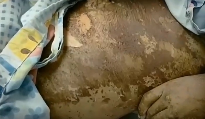 เด็กโดนซีม่า 