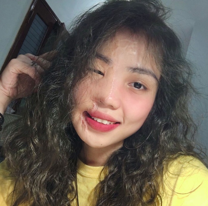 จากเสียโฉมสยอง กลับมาแจ่มว้าว 