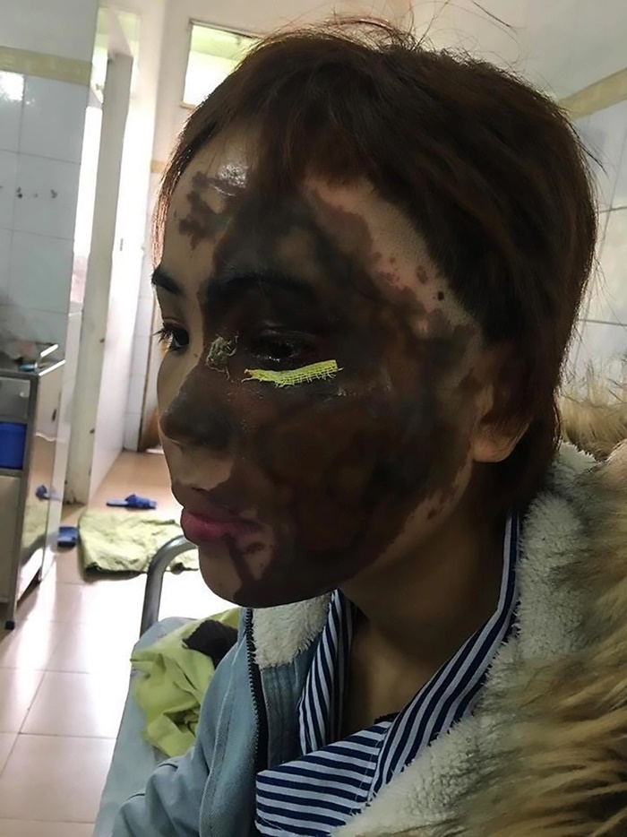 จากเสียโฉมสยอง กลับมาแจ่มว้าว 