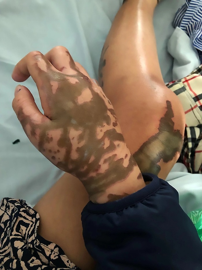 จากเสียโฉมสยอง กลับมาแจ่มว้าว 