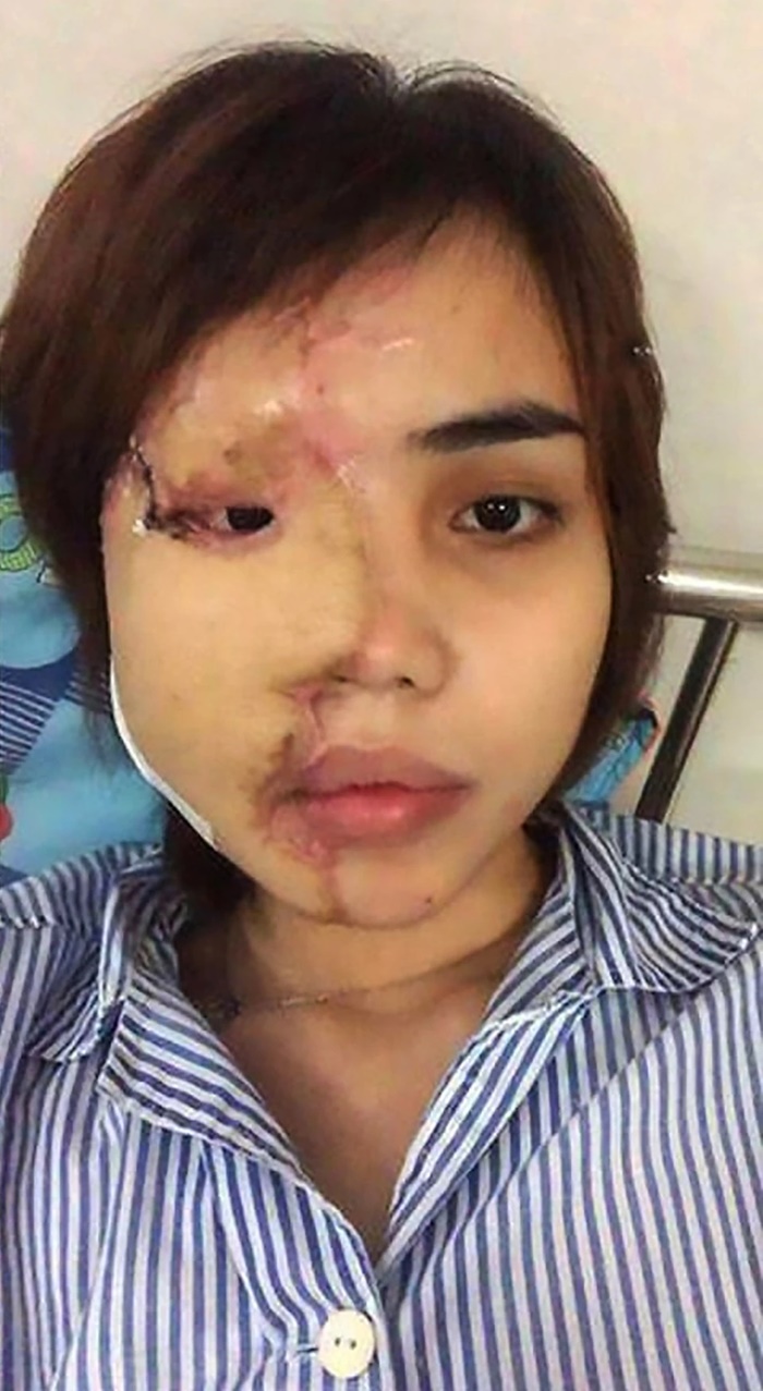 จากเสียโฉมสยอง กลับมาแจ่มว้าว 