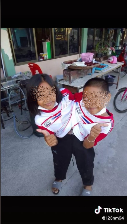 แฝดสยาม