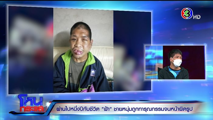 ชีวิตใหม่.. น้องฟ้า ถูกนายจ้างทารุณ 