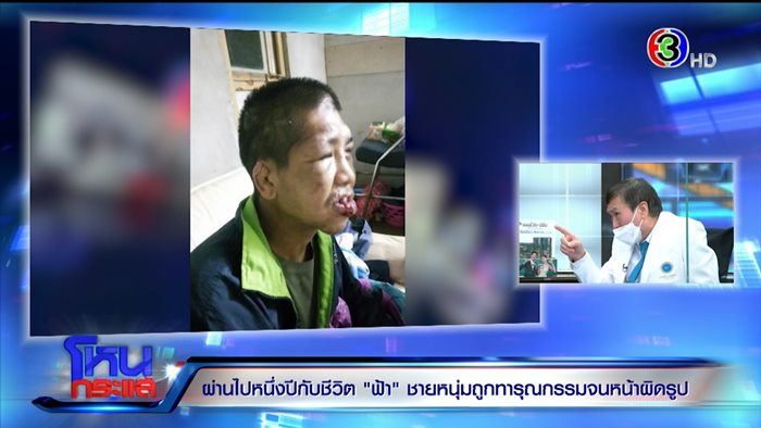 ชีวิตใหม่.. น้องฟ้า ถูกนายจ้างทารุณ 