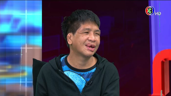 ชีวิตใหม่.. น้องฟ้า ถูกนายจ้างทารุณ 