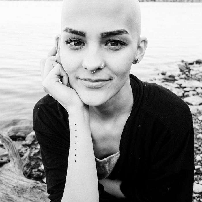 Nightbirde สาวป่วยโรคร้าย