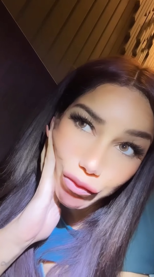 ไม่เป็นไรนะคะ ก็แค่กลับไปเลี้ยงไก่ !!