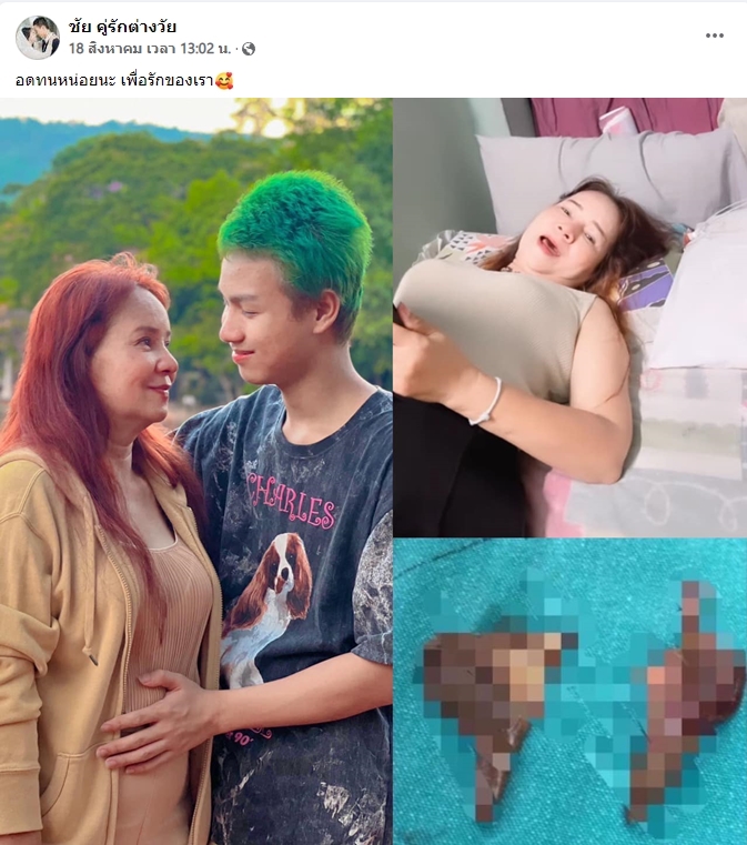 อดทนหน่อยนะ เพื่อรักของเรา