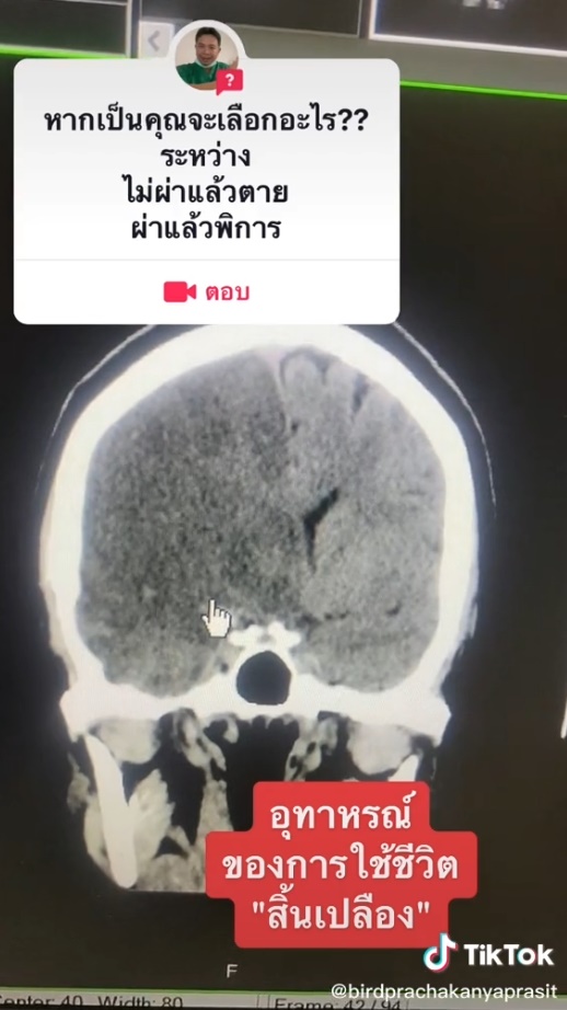 ควรเลือกทางไหน 