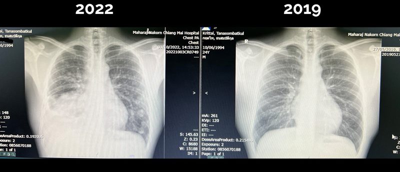 ย้อนผลงาน หมอกฤตไท 