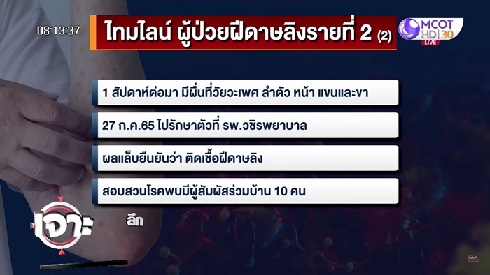 ฝีดาษลิงในไทย