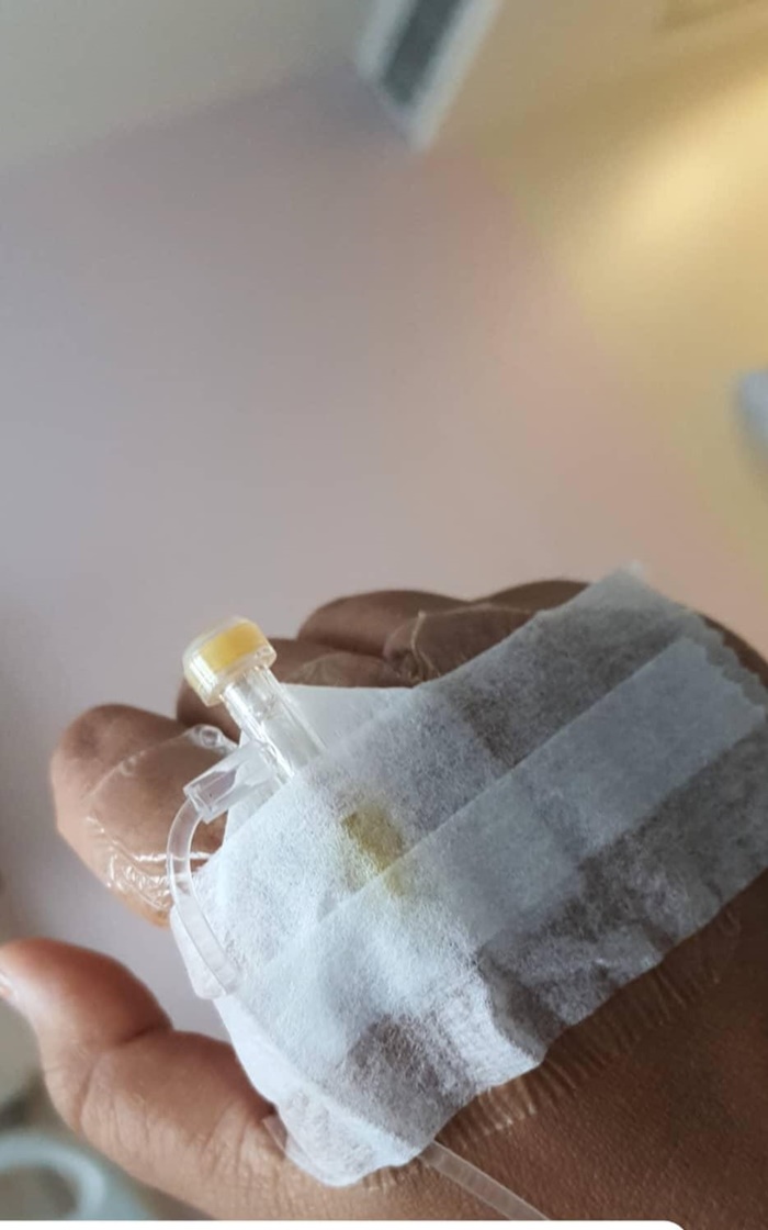 แพ้กุ้ง