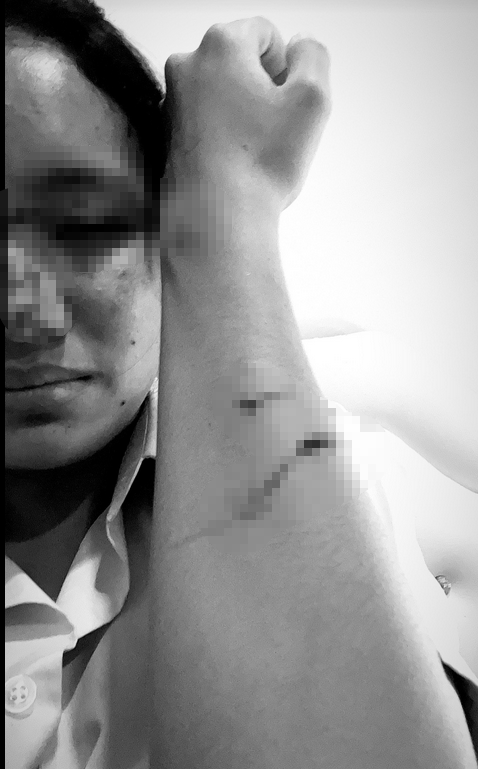 แมวข่วน