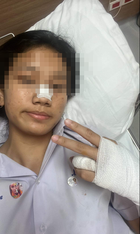 แมวข่วน