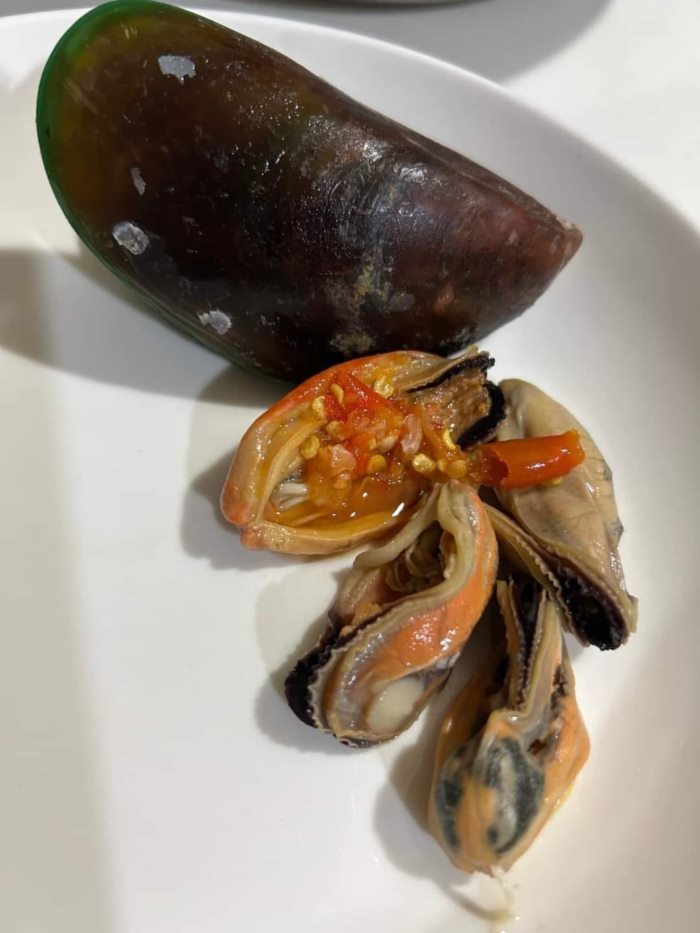 แบคทีเรียกินเนื้อ  