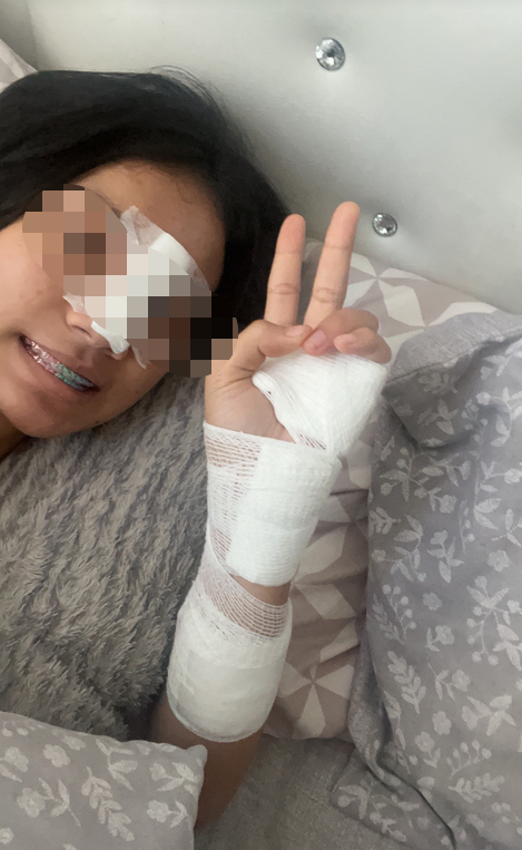 แมวข่วน