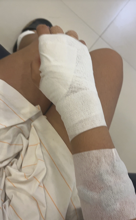 แมวข่วน