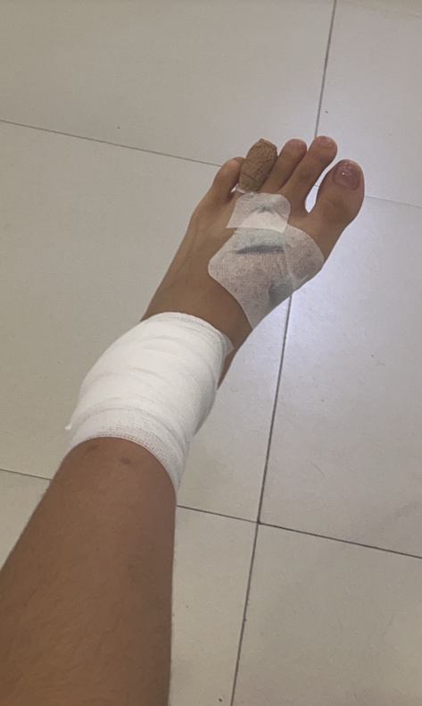 แมวข่วน