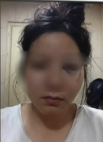 หญิงแฉผัวตำรวจทำร้าย 