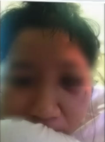 หญิงแฉผัวตำรวจทำร้าย 