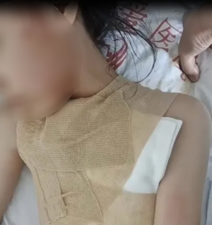 พนง. ทำซุปร้อนหกใส่ลูก