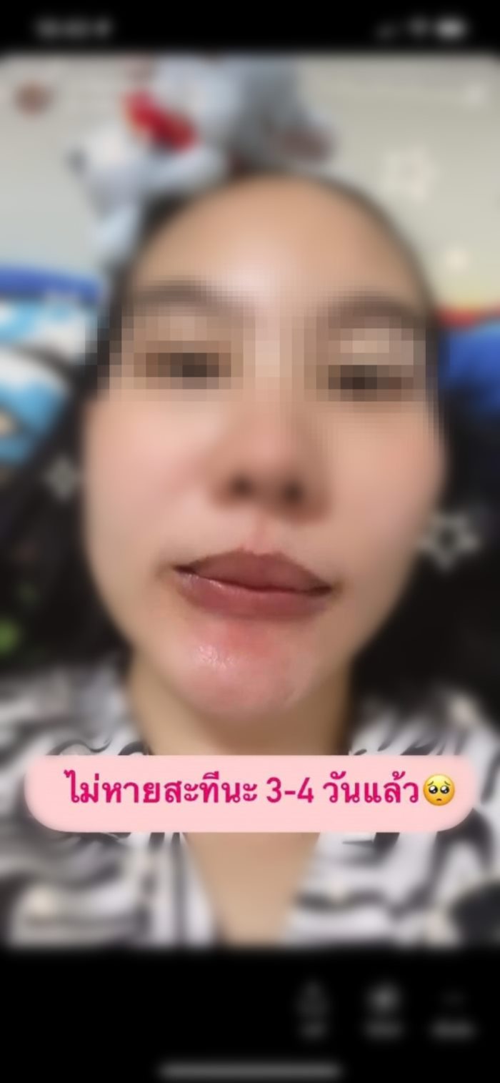  แม่ลูกอ่อนรีวิวยาสีฟัน