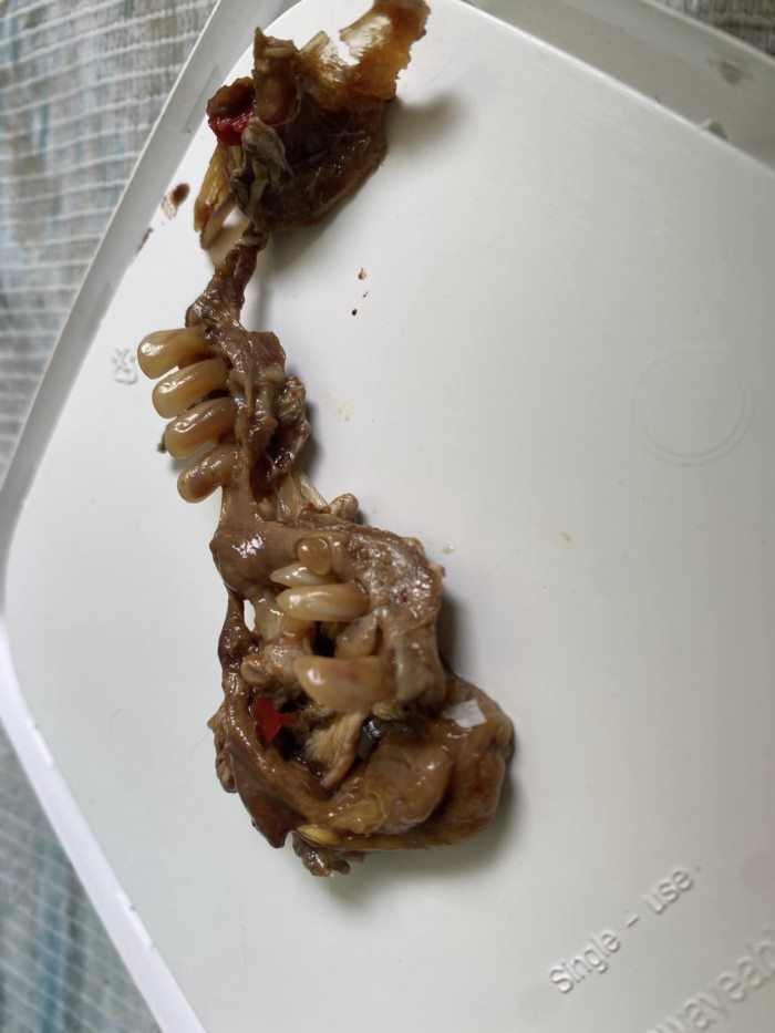 สิ่งแปลกปลอมในอาหาร